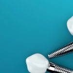 Navigating the Emotional Journey of Getting Dental Implants